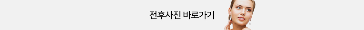전후사진더보기